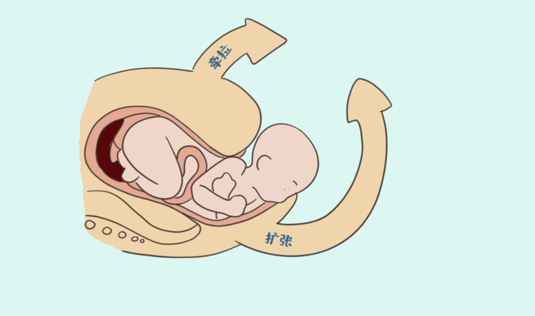 產后便秘2.png